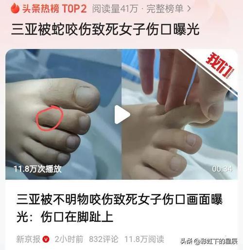 新2025澳门天天开好彩和被蛇咬反抓蛇再遭咬与被蛇咬反抓蛇再遭咬伤