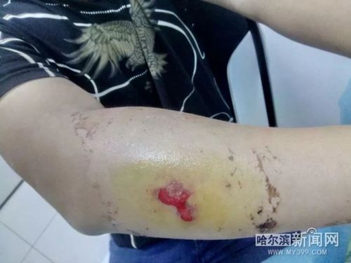 新澳天天开奖资料大全最新版和被蛇咬反抓蛇再遭咬与被蛇咬反抓蛇再遭咬伤